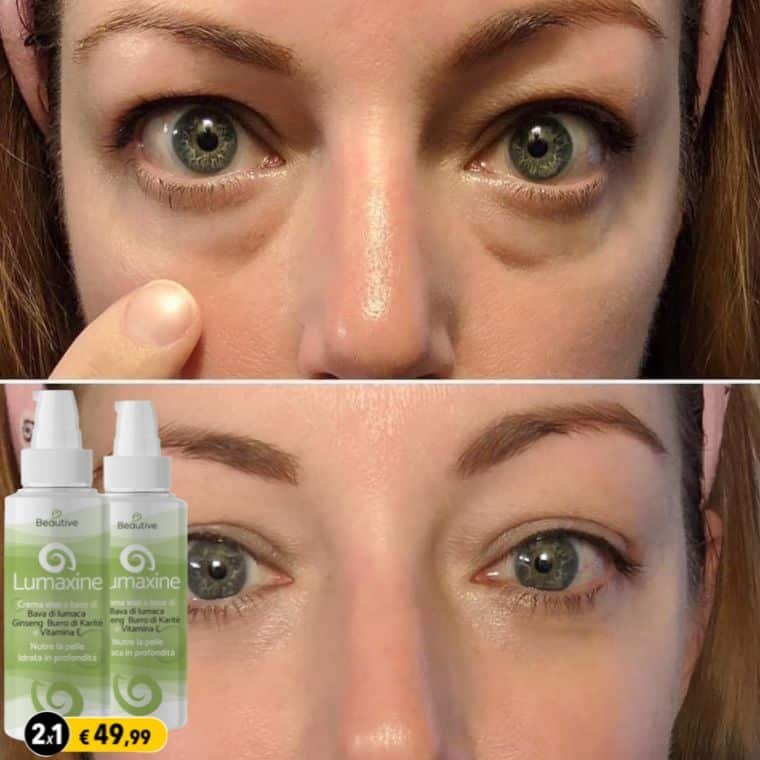 crema bava lumaca rughe donne